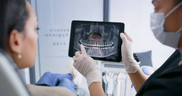 Licensed Wisdom Tooth Removal service in New Burlington, OH - Smile Center Dentistry